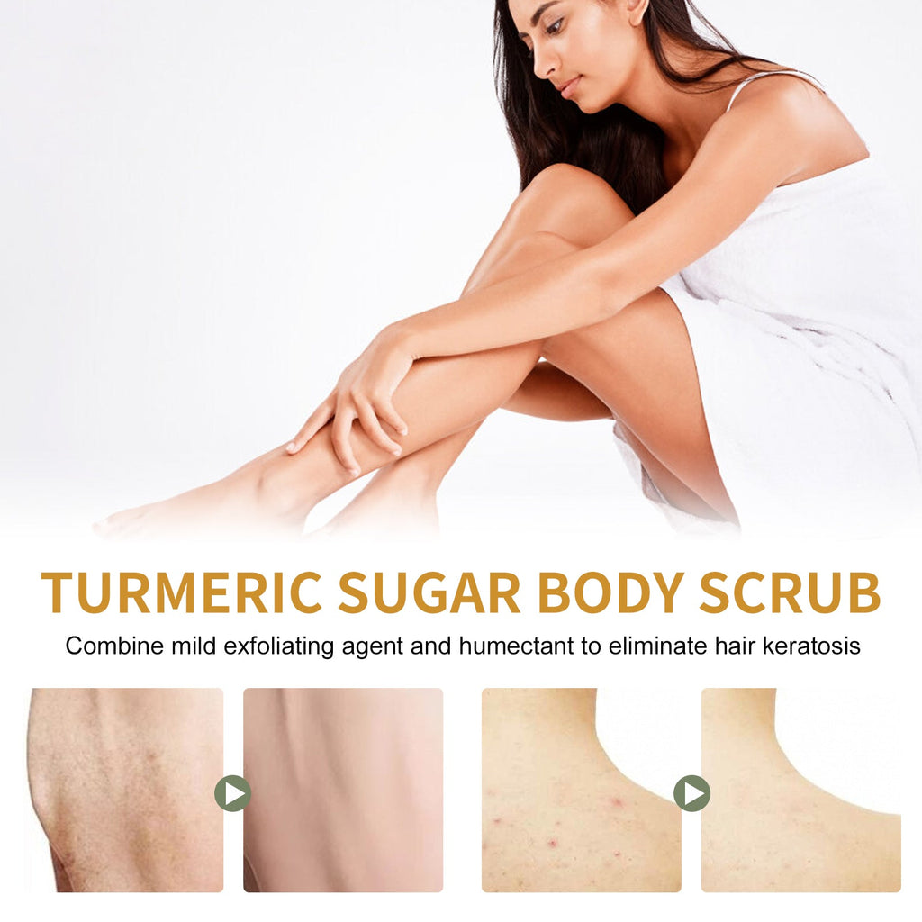 Turmeric Body Scrub Lightens Acne Marks, Moisturizes, Refreshes, Cleanses & Exfoliates Body Scrubs - Purity Muse